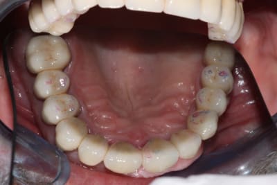 Img 2621 pfxwbb - Eugenol