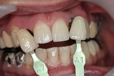 Img 2639 xvttp7 - Eugenol