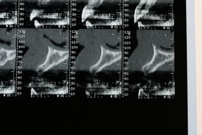 Img 2643 wmo15t - Eugenol