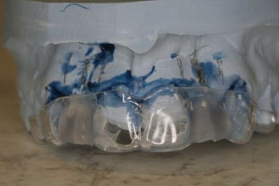 Img 2648 cm9ze1 - Eugenol