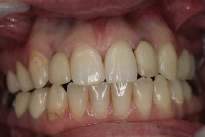 Img 2658 zp6y1q - Eugenol