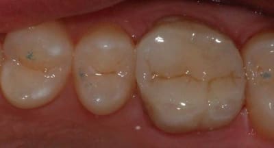 Img 2766 ki58hi - Eugenol