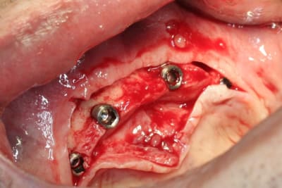 Img 2787 ayujgd - Eugenol