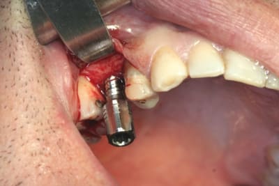 Img 2801 e00kov - Eugenol