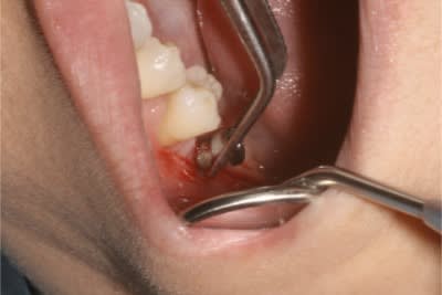 Img 2854 gfjpw6 - Eugenol