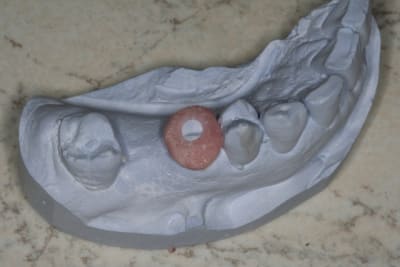 Img 2883 bjh0hk - Eugenol