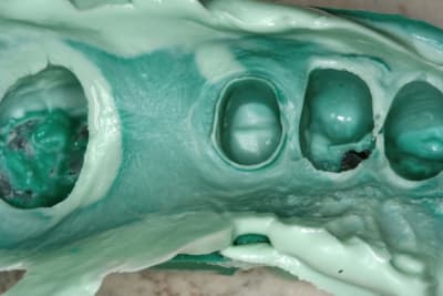 Img 2886 nbtsoz - Eugenol