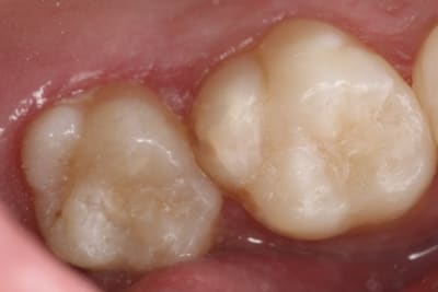 Img 2988 rzdqqz - Eugenol