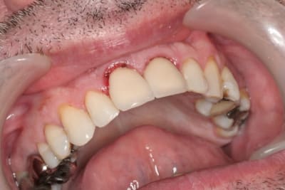 Img 3020 cfor6c - Eugenol