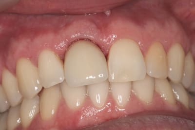 Img 3107 u8tlsy - Eugenol