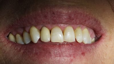 Img 3292 y8femf - Eugenol