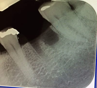 Img 3516 caztrv - Eugenol