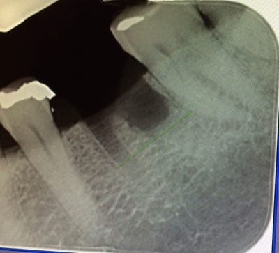 Img 3516 dx2ff1 - Eugenol