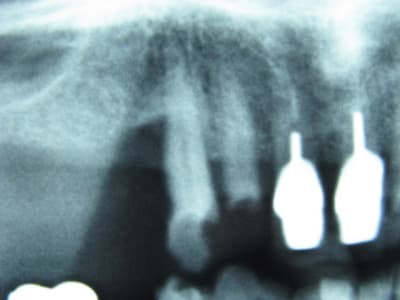 Img 3609 vfxreo - Eugenol