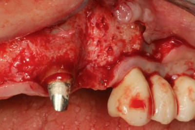 Img 4239 n1srju - Eugenol