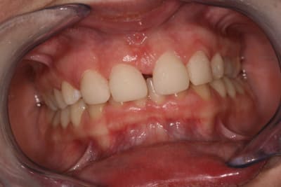 Img 4263 rsgdfy - Eugenol