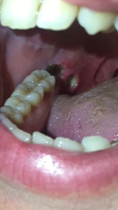 Img 4343 by0sj3 - Eugenol