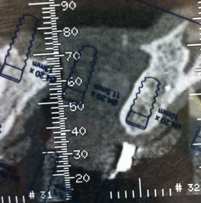 Img 4565 pphojo - Eugenol