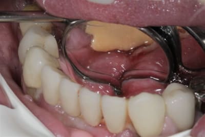 Img 4624 nzgd5v - Eugenol