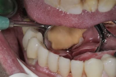 Img 4625 vtat5y - Eugenol