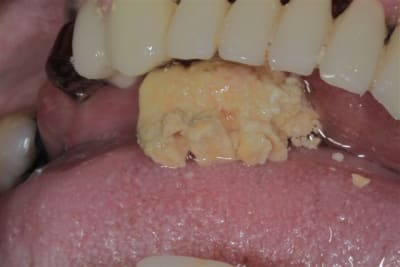 Img 4626 ptxkkd - Eugenol