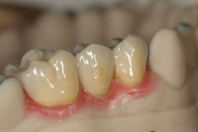 Img 4696 1 i4o5ys - Eugenol
