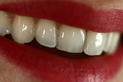 Img 4726  custom  iw1xzw - Eugenol