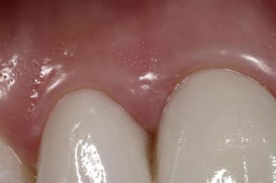 Img 4881  custom  fjuwwa - Eugenol