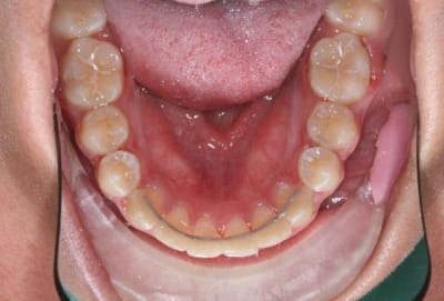 Img 4 r3tw6u - Eugenol