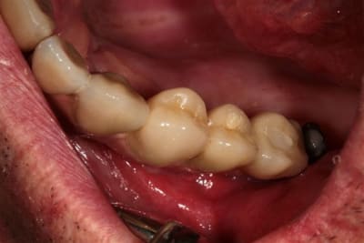 Img 5021 djqsws - Eugenol