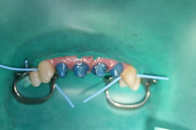 Img 5088 ejr0sy - Eugenol