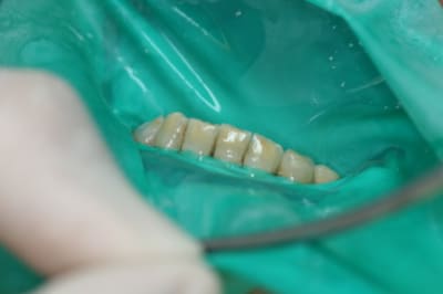 Img 5144 xc6wx1 - Eugenol