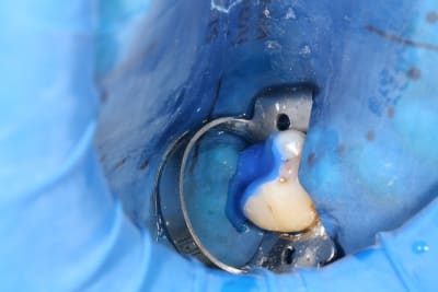 Img 5170 dxi6d5 - Eugenol