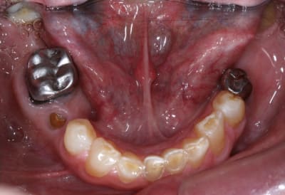 Img 5232 esfvne - Eugenol