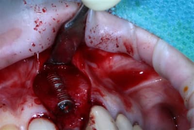 Img 5295 qlgmoq - Eugenol