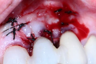 Img 5300 mpytpx - Eugenol