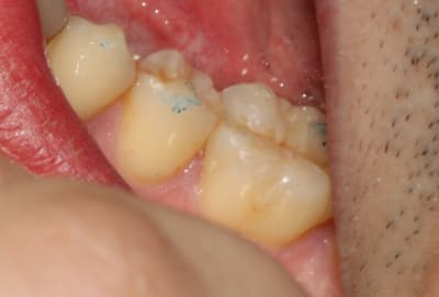 Img 5554 cifnmi - Eugenol