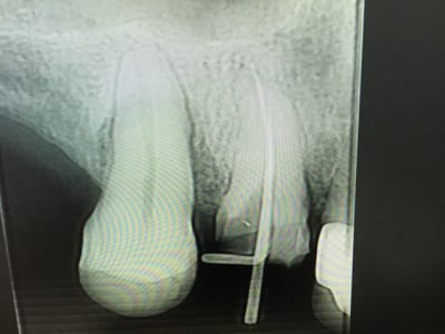 Img 5576 gdwybq - Eugenol