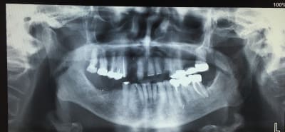 Img 5601 bwdnca - Eugenol