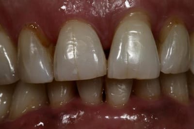 Img 5722  custom  pkesln - Eugenol