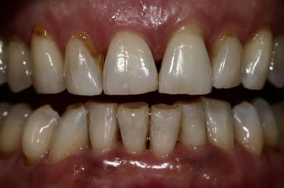 Img 5724  custom  s4vnde - Eugenol