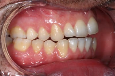 Img 5805 ofbnsu - Eugenol