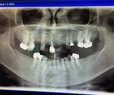 Img 5974 ype0dm - Eugenol
