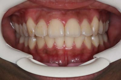 Img 5 gpdjde - Eugenol