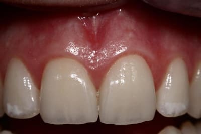 Img 6024  large  dv45n0 - Eugenol