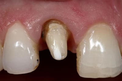 Img 6038  large  c54pvh - Eugenol