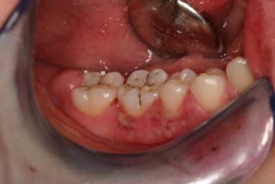 Img 6095 n6l9vy - Eugenol