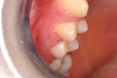 Img 6097 kgdlds - Eugenol