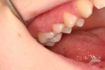 Img 6098 fc3mgk - Eugenol