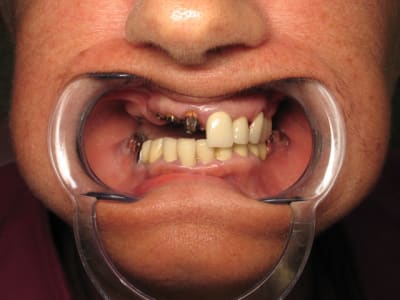 Img 6118 osgqi0 - Eugenol